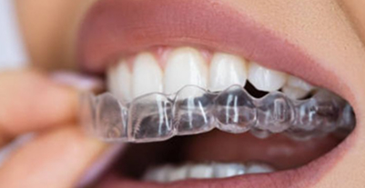 Invisalign & Orthodontics